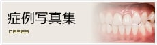 症例写真集
